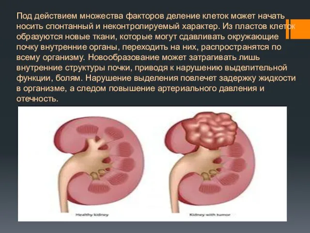 Под действием множества факторов деление клеток может начать носить спонтанный и