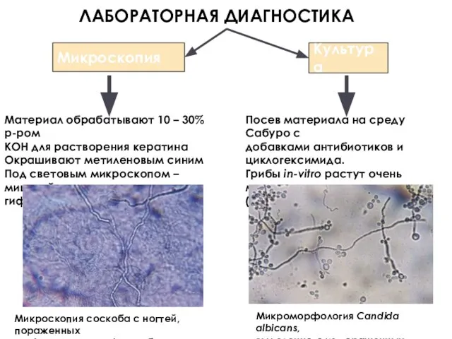 ЛАБОРАТОРНАЯ ДИАГНОСТИКА Микроскопия Культура Материал обрабатывают 10 – 30% р-ром КОН