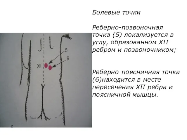 Болевые точки Реберно-позвоночная точка (5) локализуется в углу, образованном XII ребром