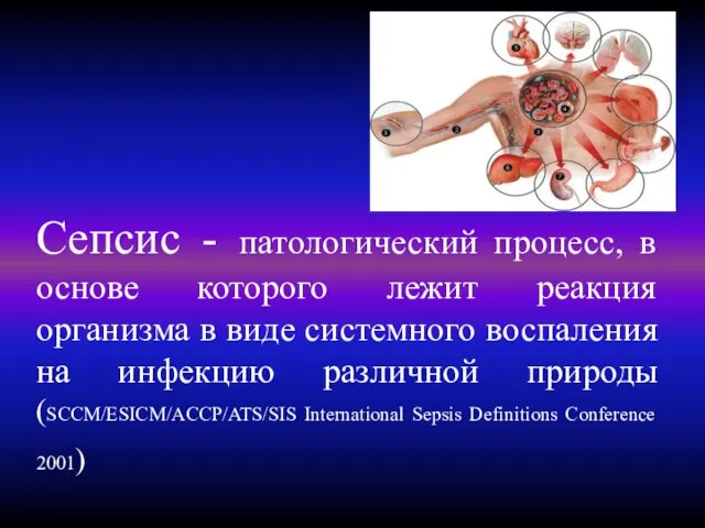 Сепсис - патологический процесс, в основе которого лежит реакция организма в