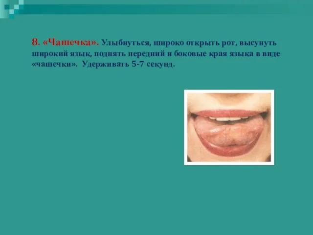 8. «Чашечка». Улыбнуться, широко открыть рот, высунуть широкий язык, поднять передний