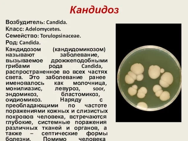 Кандидоз Возбудитель: Candida. Класс: Adelomycetes. Семейство: Torulopsinaceae. Род: Candida. Кандидозом (кандидомикозом)