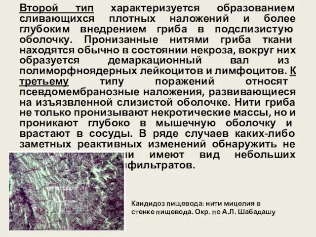 Кандидоз пищевода: нити мицелия в стенке пищевода. Окр. по А.Л. Шабадашу