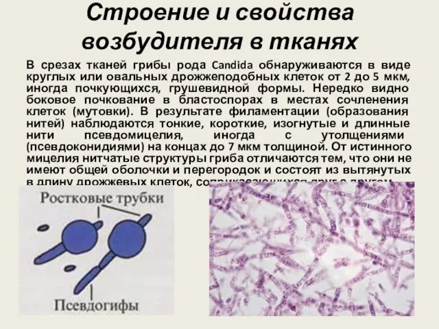 Строение и свойства возбудителя в тканях В срезах тканей грибы рода