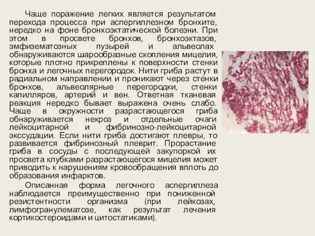 Чаще поражение легких является результатом перехода процесса при аспергиллезном бронхите, нередко