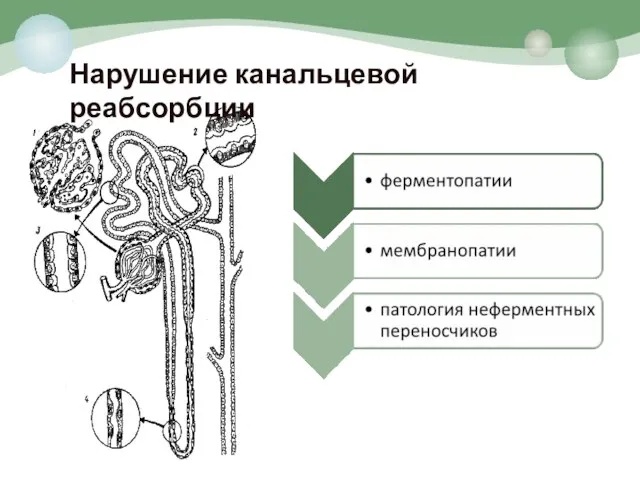 Нарушение канальцевой реабсорбции