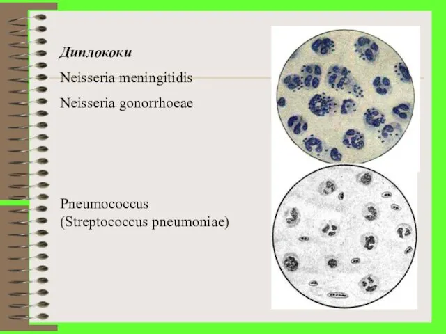 Диплококи Neisseria meningitidis Neisseria gonorrhoeae Pneumococcus (Streptococcus pneumoniae)