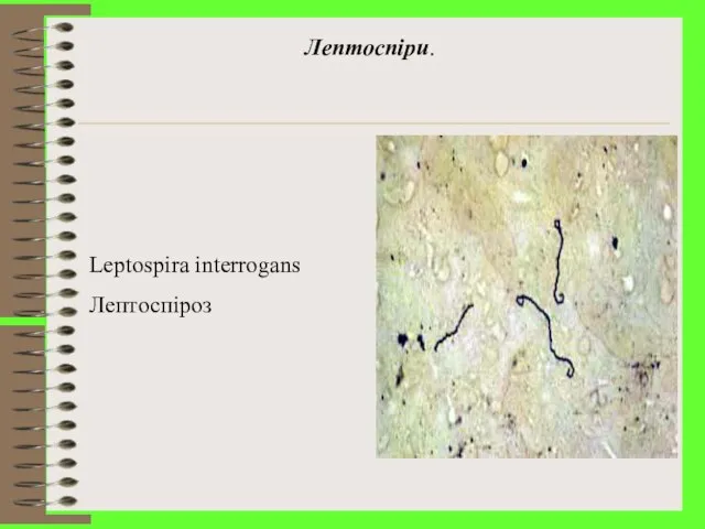 Лептоспіри. Leptospira interrogans Лептоспіроз