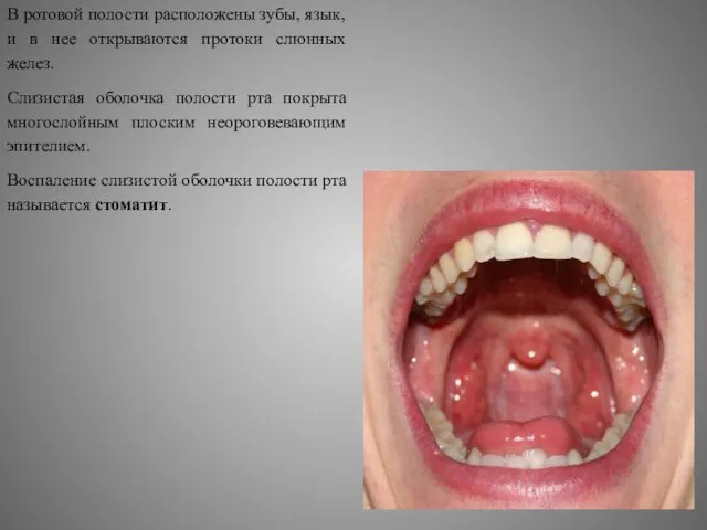 В ротовой полости расположены зубы, язык, и в нее открываются протоки