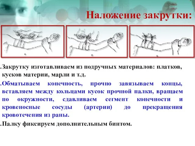 Наложение закрутки: Закрутку изготавливаем из подручных материалов: платков, кусков материи, марли