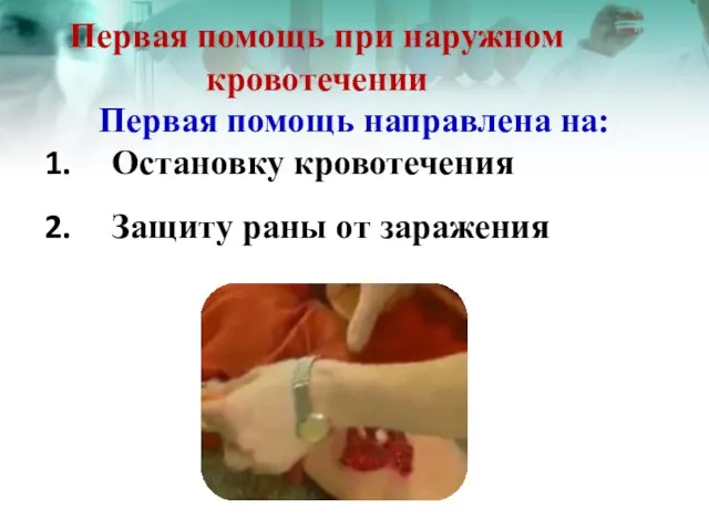 Первая помощь при наружном кровотечении Первая помощь направлена на: Остановку кровотечения Защиту раны от заражения