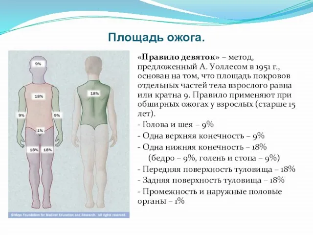 Площадь ожога. «Правило девяток» – метод, предложенный А. Уоллесом в 1951
