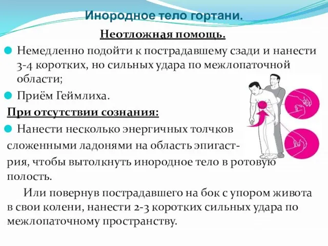 Инородное тело гортани. Неотложная помощь. Немедленно подойти к пострадавшему сзади и