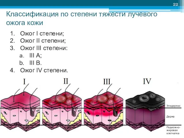 Классификация по степени тяжести лучевого ожога кожи Ожог I степени; Ожог