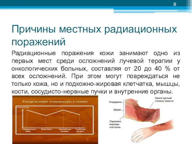 Причины местных радиационных поражений Радиационные поражения кожи занимают одно из первых