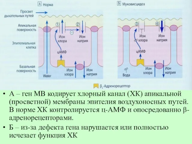 А – ген МВ кодирует хлорный канал (ХК) апикальной (просветной) мембраны