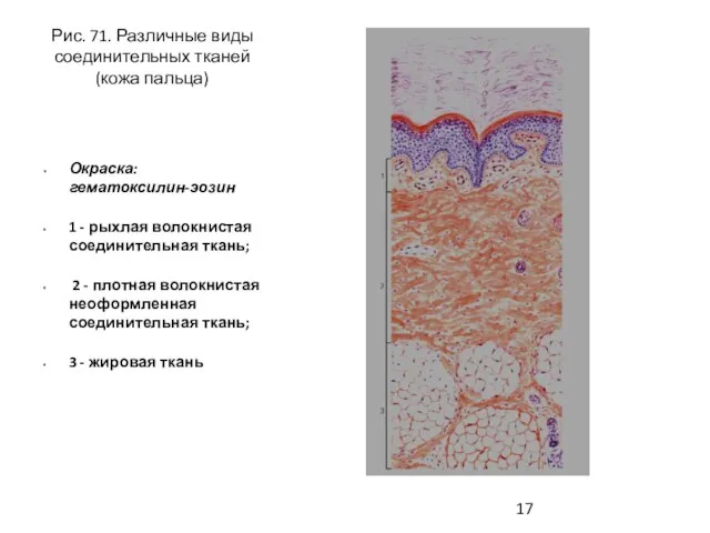 Рис. 71. Различные виды соединительных тканей (кожа пальца) Окраска: гематоксилин-эозин 1