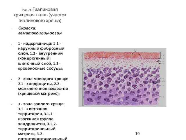 Рис. 74. Гиалиновая хрящевая ткань (участок гиалинового хряща) Окраска: гематоксилин-эозин 1