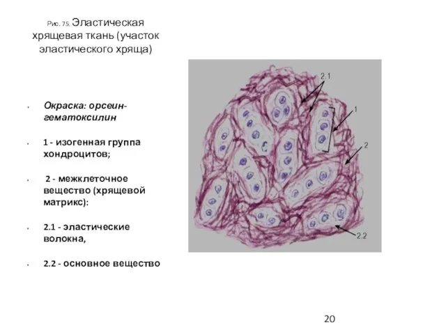 Рис. 75. Эластическая хрящевая ткань (участок эластического хряща) Окраска: орсеин-гематоксилин 1