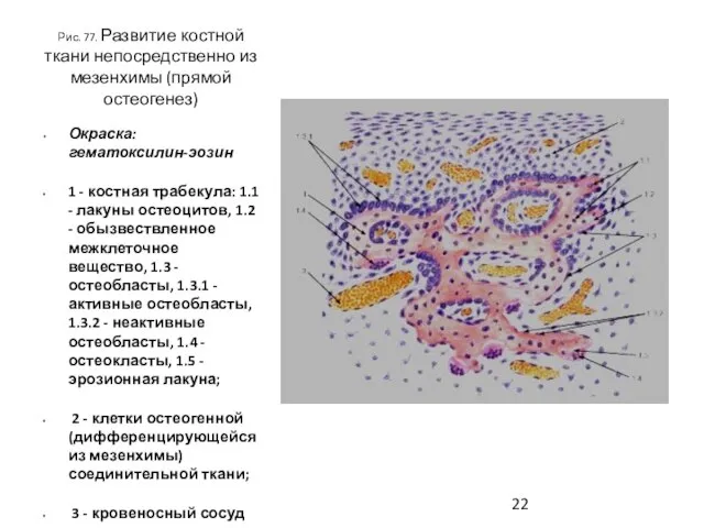 Рис. 77. Развитие костной ткани непосредственно из мезенхимы (прямой остеогенез) Окраска: