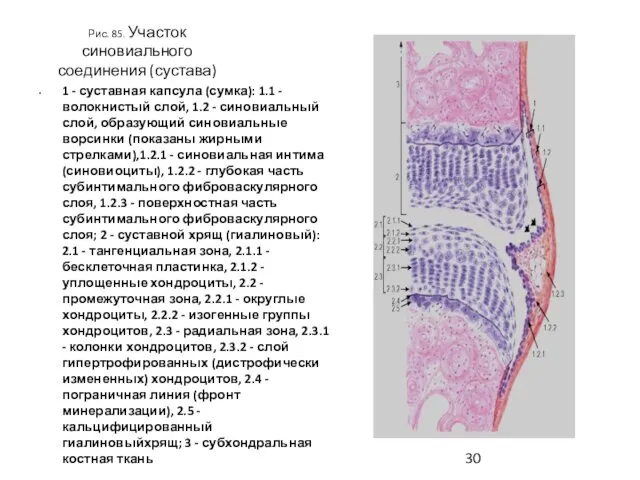 Рис. 85. Участок синовиального соединения (сустава) 1 - суставная капсула (сумка):