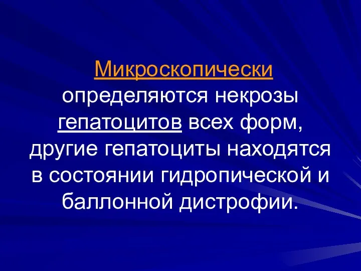 Микроскопически определяются некрозы гепатоцитов всех форм, другие гепатоциты находятся в состоянии гидропической и баллонной дистрофии.