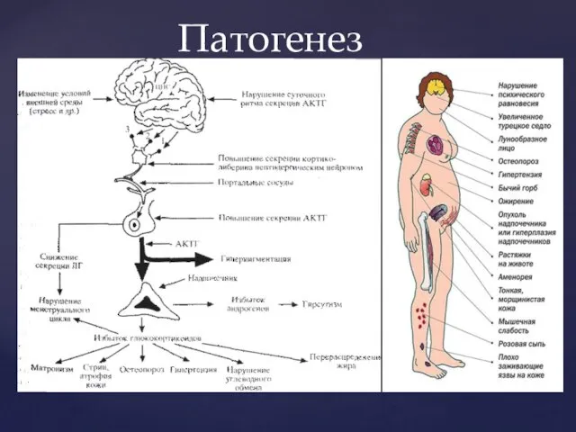 Патогенез