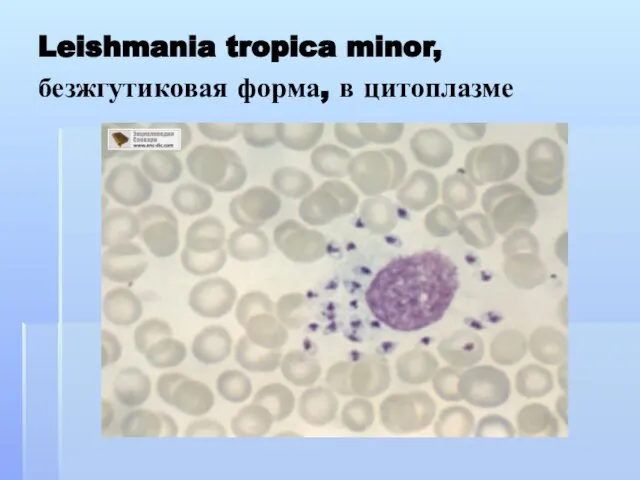 Leishmania tropica minor, безжгутиковая форма, в цитоплазме