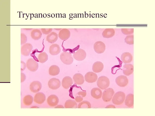 Trypanosoma gambiense