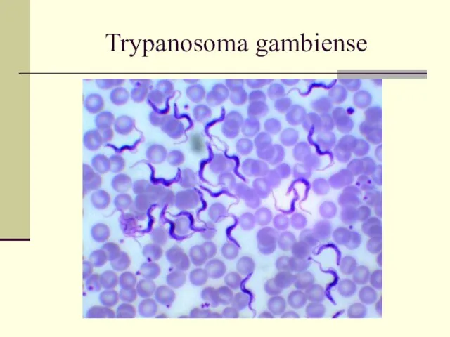 Trypanosoma gambiense