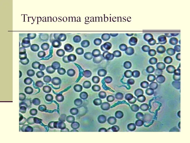 Trypanosoma gambiense