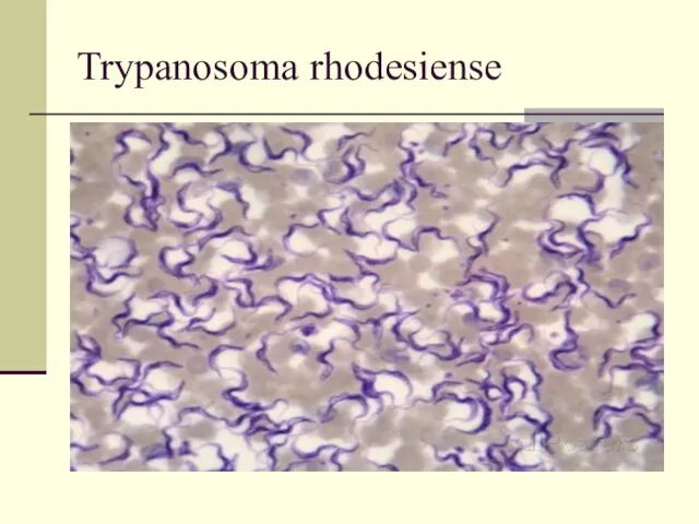 Trypanosoma rhodesiense