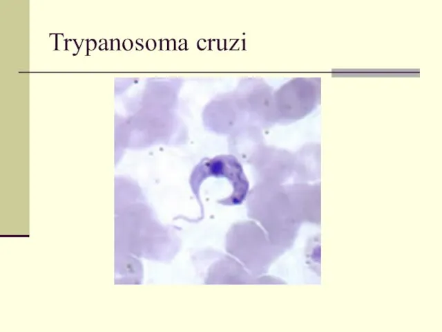 Trypanosoma cruzi