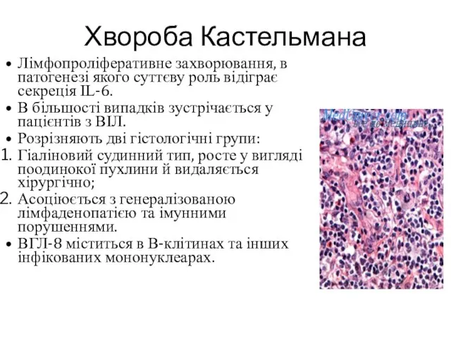 Хвороба Кастельмана Лімфопроліферативне захворювання, в патогенезі якого суттєву роль відіграє секреція
