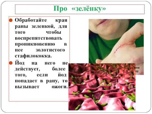 Про «зелёнку» Обработайте края раны зеленкой, для того чтобы воспрепятствовать проникновению