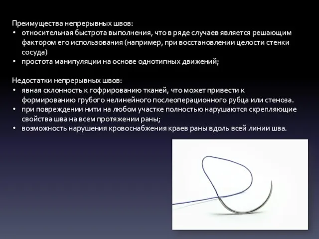 Преимущества непрерывных швов: относительная быстрота выполнения, что в ряде случаев является