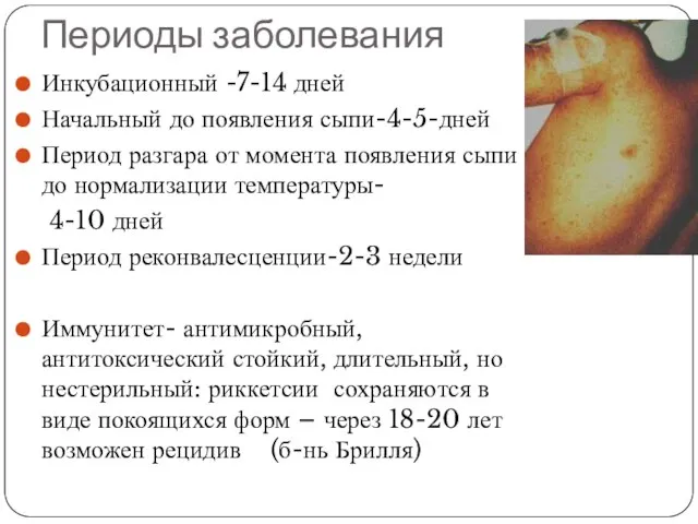 Периоды заболевания Инкубационный -7-14 дней Начальный до появления сыпи-4-5-дней Период разгара