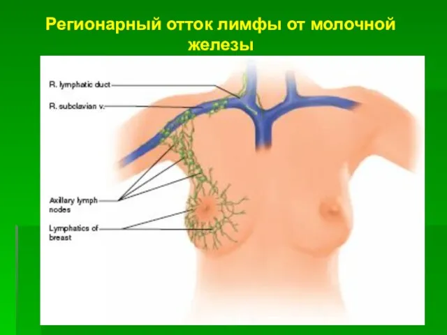 Регионарный отток лимфы от молочной железы