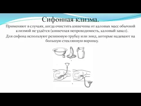 Сифонная клизма. Применяют в случаях, когда очистить кишечник от каловых масс