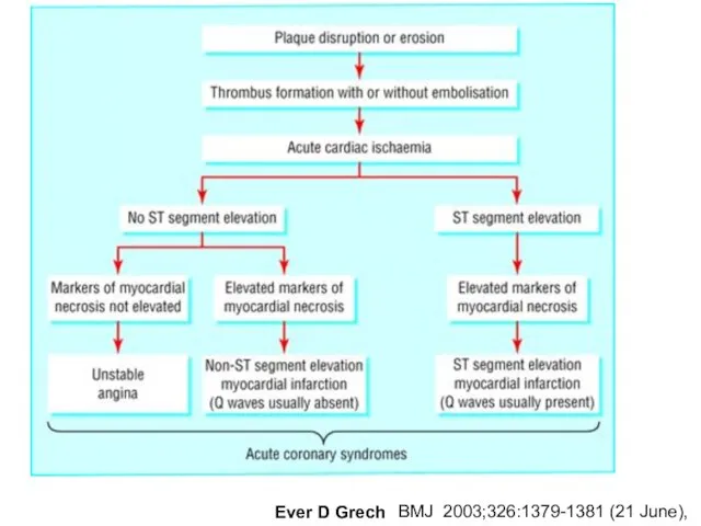 BMJ 2003;326:1379-1381 (21 June), Ever D Grech