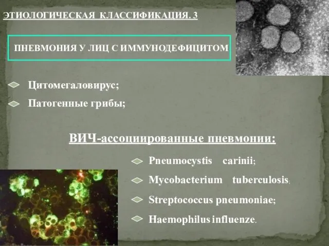 Цитомегаловирус; Патогенные грибы; ВИЧ-ассоциированные пневмонии: Pneumocystis carinii; Mycobacterium tuberculosis; Streptococcus pneumoniae; Haemophilus influenze. ЭТИОЛОГИЧЕСКАЯ КЛАССИФИКАЦИЯ. 3