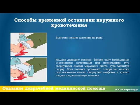 Способы временной остановки наружного кровотечения Выполни прямое давление на рану. Наложи