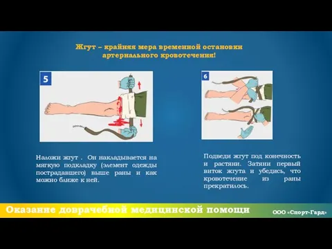 Наложи жгут . Он накладывается на мягкую подкладку (элемент одежды пострадавшего)