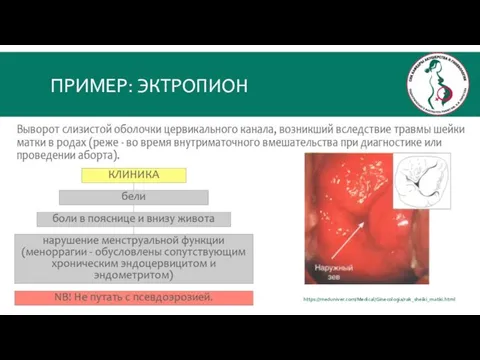 ПРИМЕР: ЭКТРОПИОН https://meduniver.com/Medical/Ginecologia/rak_sheiki_matki.html