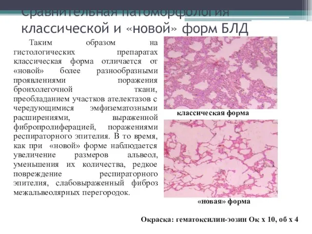 Сравнительная патоморфология классической и «новой» форм БЛД Таким образом на гистологических