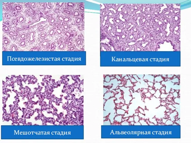 Псевдожелезистая стадия Канальцевая стадия Мешотчатая стадия Альвеолярная стадия