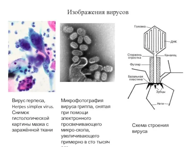 Изображения вирусов Вирус герпеса, Herpes simplex virus. Снимок гистологической картины мазка