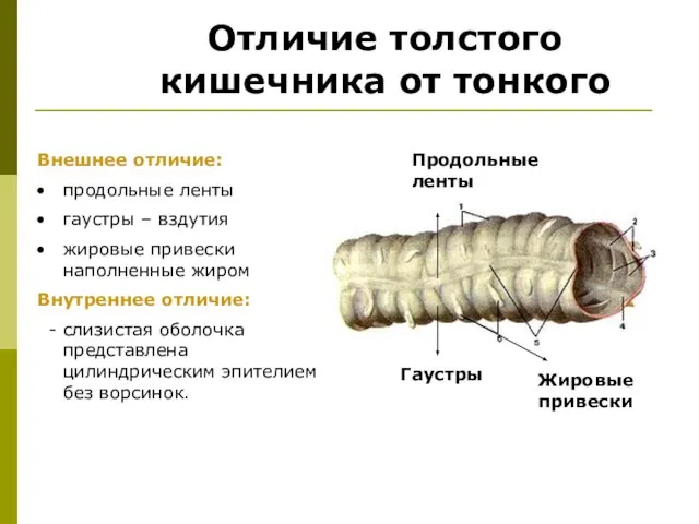 Отличие толстого кишечника от тонкого Внешнее отличие: продольные ленты гаустры –