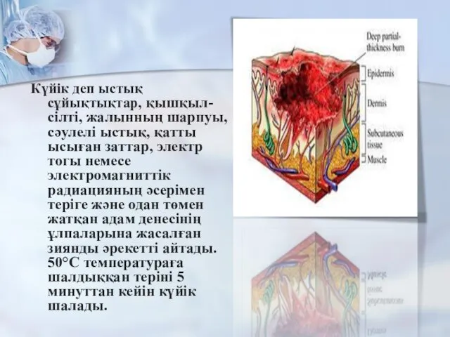 Күйік деп ыстық сұйықтықтар, қышқыл-сілті, жалынның шарпуы, сәулелі ыстық, қатты ысыған