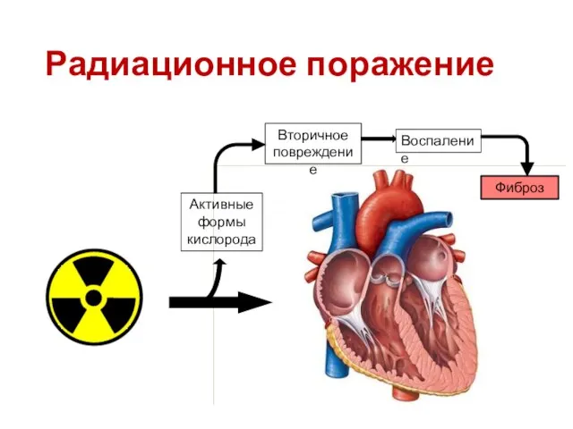 Радиационное поражение Активные формы кислорода Вторичное повреждение Воспаление Фиброз